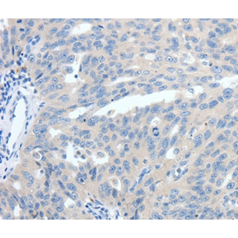 Immunohistochemistry - SSTR3 Antibody from Signalway Antibody (37258) - Antibodies.com