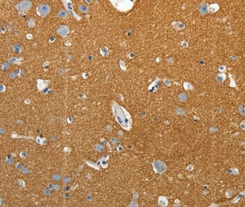 Immunohistochemical analysis of paraffin-embedded Human brain tissue using #37259 at dilution 1/25.