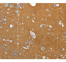 Immunohistochemistry - SSTR4 Antibody from Signalway Antibody (37259) - Antibodies.com