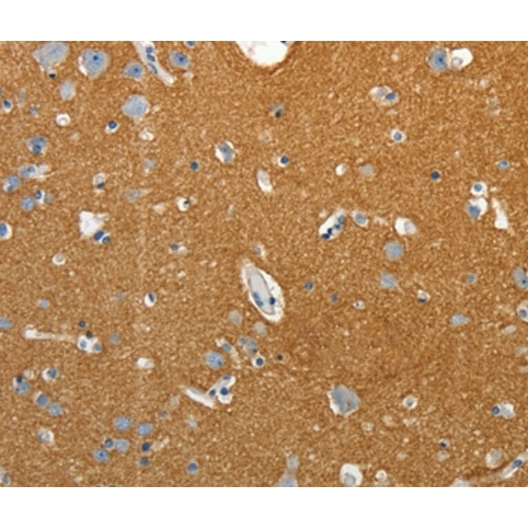 Immunohistochemistry - SSTR4 Antibody from Signalway Antibody (37259) - Antibodies.com