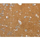 Immunohistochemistry - SSTR4 Antibody from Signalway Antibody (37259) - Antibodies.com