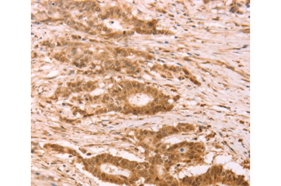 Immunohistochemistry - STRA8 Antibody from Signalway Antibody (37262) - Antibodies.com