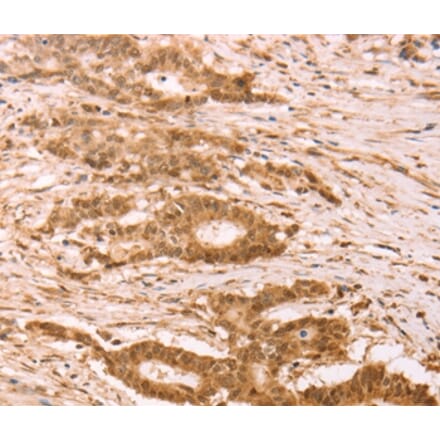 Immunohistochemistry - STRA8 Antibody from Signalway Antibody (37262) - Antibodies.com