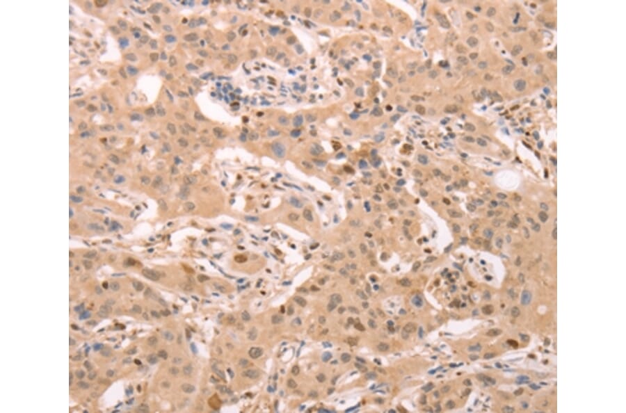 Immunohistochemistry - STRA8 Antibody from Signalway Antibody (37262) - Antibodies.com