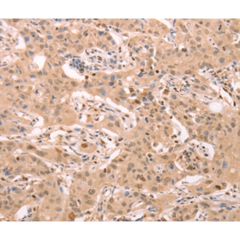Immunohistochemistry - STRA8 Antibody from Signalway Antibody (37262) - Antibodies.com