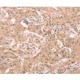 Immunohistochemistry - STRA8 Antibody from Signalway Antibody (37262) - Antibodies.com