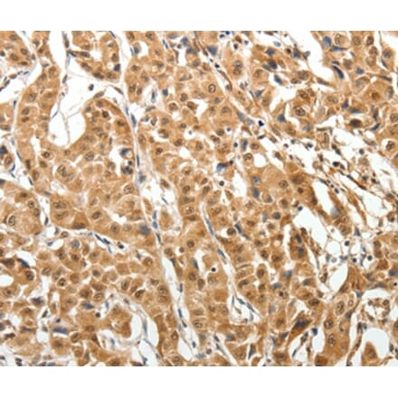 Immunohistochemistry - MAP1A Antibody from Signalway Antibody (37265) - Antibodies.com