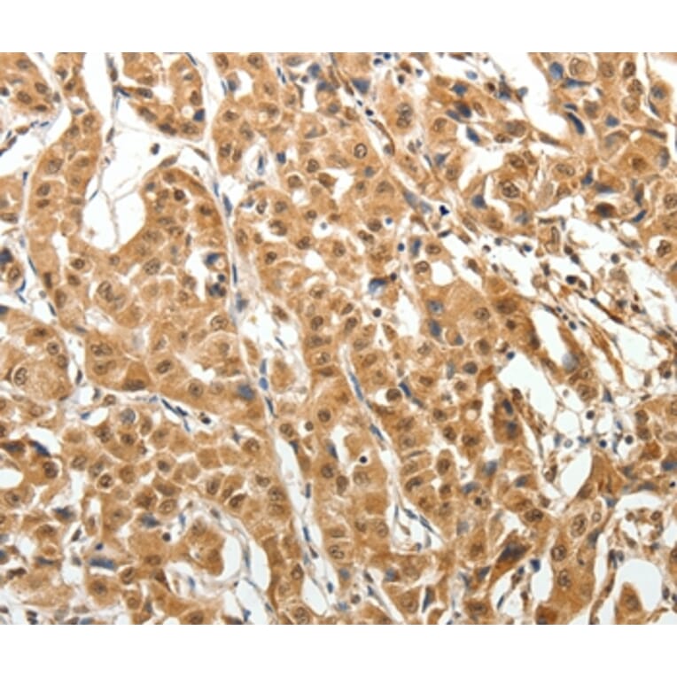 Immunohistochemistry - MAP1A Antibody from Signalway Antibody (37265) - Antibodies.com