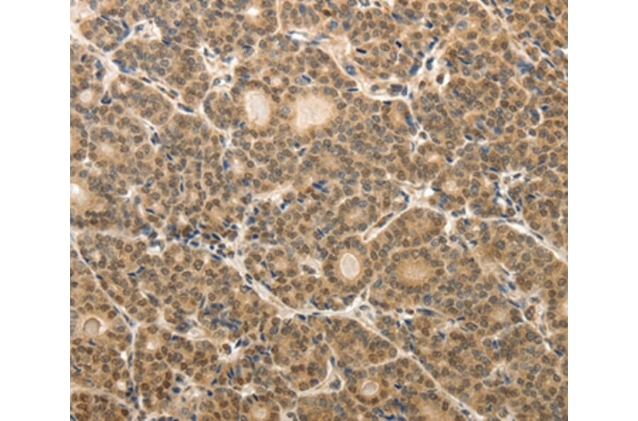 Immunohistochemistry - MAP1A Antibody from Signalway Antibody (37265) - Antibodies.com
