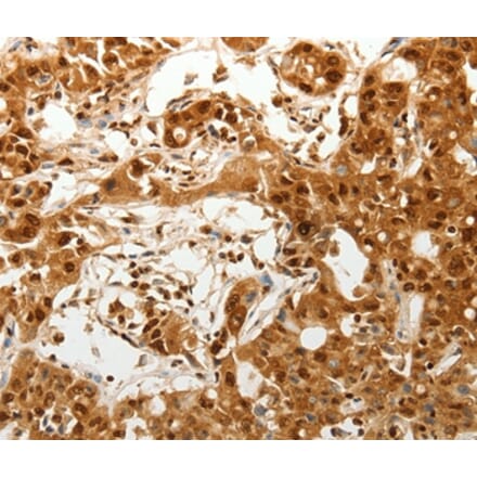 Immunohistochemistry - TENM3 Antibody from Signalway Antibody (37270) - Antibodies.com