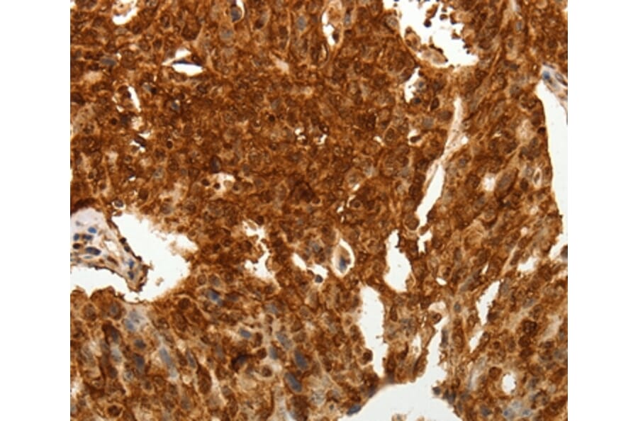 Immunohistochemistry - TENM3 Antibody from Signalway Antibody (37270) - Antibodies.com