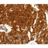 Immunohistochemistry - TENM3 Antibody from Signalway Antibody (37270) - Antibodies.com