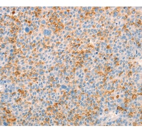 Immunohistochemistry - TRPM7 Antibody from Signalway Antibody (37281) - Antibodies.com