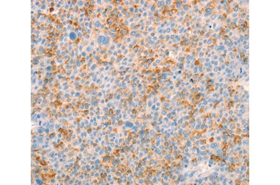 Immunohistochemistry - TRPM7 Antibody from Signalway Antibody (37281) - Antibodies.com