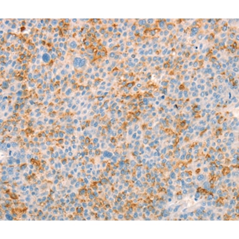 Immunohistochemistry - TRPM7 Antibody from Signalway Antibody (37281) - Antibodies.com