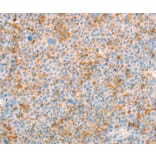 Immunohistochemistry - TRPM7 Antibody from Signalway Antibody (37281) - Antibodies.com