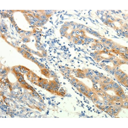 Immunohistochemistry - TRPA1 Antibody from Signalway Antibody (37282) - Antibodies.com