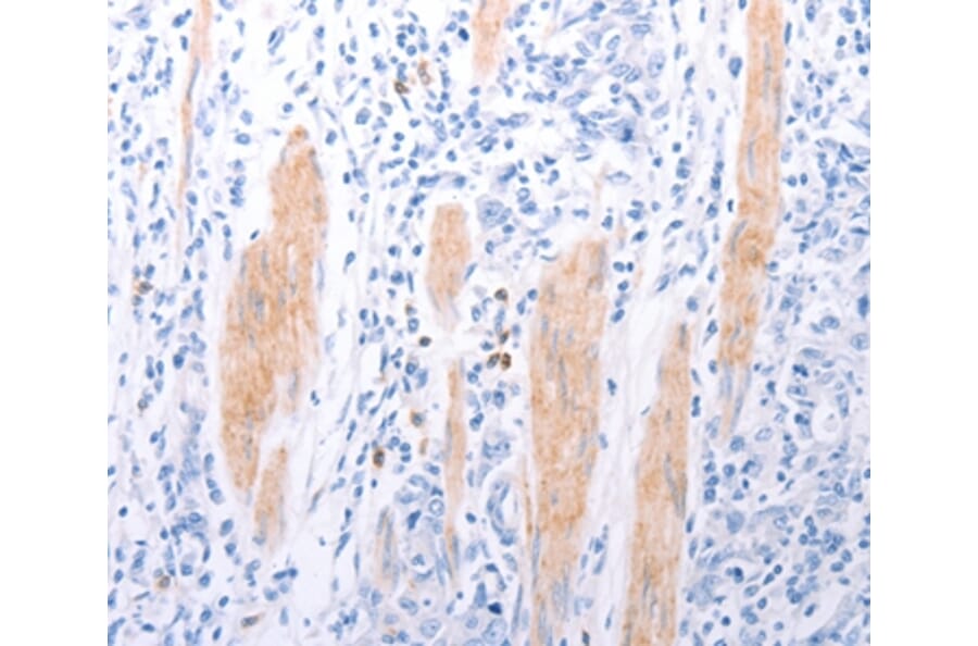 Immunohistochemistry - LPAR2 Antibody from Signalway Antibody (37287) - Antibodies.com