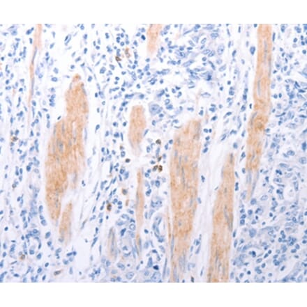 Immunohistochemistry - LPAR2 Antibody from Signalway Antibody (37287) - Antibodies.com