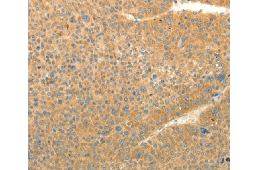 Immunohistochemistry - LPAR3 Antibody from Signalway Antibody (37292) - Antibodies.com
