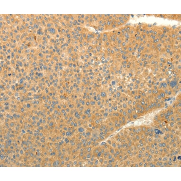 Immunohistochemistry - LPAR3 Antibody from Signalway Antibody (37292) - Antibodies.com