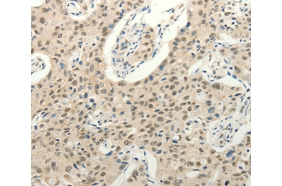 Immunohistochemistry - FZD10 Antibody from Signalway Antibody (37298) - Antibodies.com