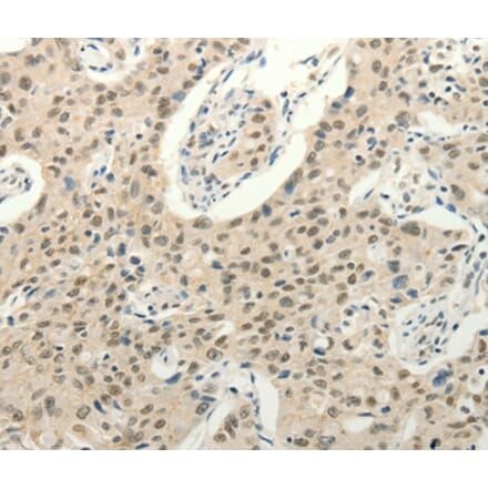 Immunohistochemistry - FZD10 Antibody from Signalway Antibody (37298) - Antibodies.com