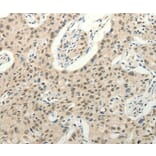 Immunohistochemistry - FZD10 Antibody from Signalway Antibody (37298) - Antibodies.com