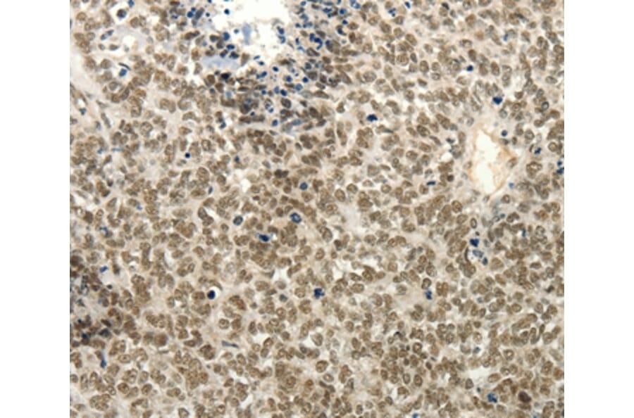 Immunohistochemistry - FZD10 Antibody from Signalway Antibody (37298) - Antibodies.com