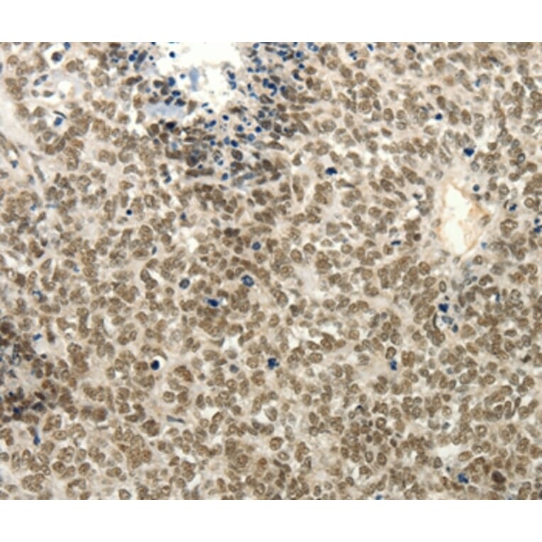 Immunohistochemistry - FZD10 Antibody from Signalway Antibody (37298) - Antibodies.com