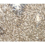 Immunohistochemistry - FZD10 Antibody from Signalway Antibody (37298) - Antibodies.com
