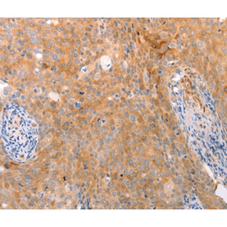 Immunohistochemistry - ABCA2 Antibody from Signalway Antibody (37304) - Antibodies.com