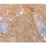 Immunohistochemistry - ABCA2 Antibody from Signalway Antibody (37304) - Antibodies.com