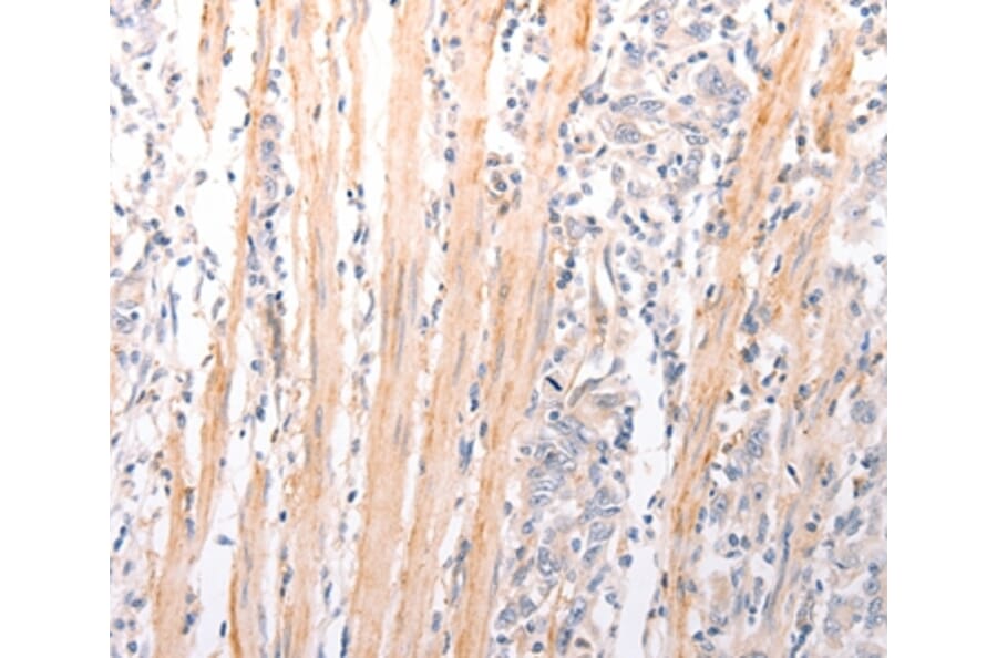 Immunohistochemistry - ABCA2 Antibody from Signalway Antibody (37304) - Antibodies.com