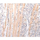 Immunohistochemistry - ABCA2 Antibody from Signalway Antibody (37304) - Antibodies.com