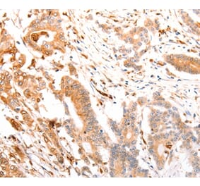 Immunohistochemistry - ABCA4 Antibody from Signalway Antibody (37305) - Antibodies.com