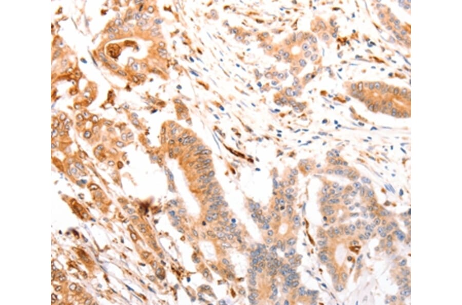 Immunohistochemistry - ABCA4 Antibody from Signalway Antibody (37305) - Antibodies.com