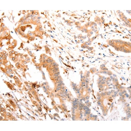 Immunohistochemistry - ABCA4 Antibody from Signalway Antibody (37305) - Antibodies.com