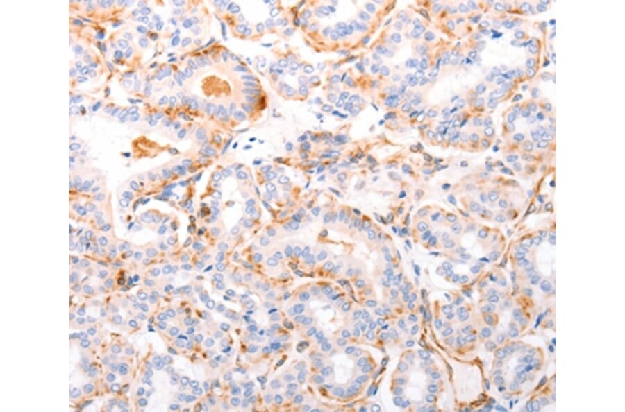 Immunohistochemistry - ABCA4 Antibody from Signalway Antibody (37305) - Antibodies.com