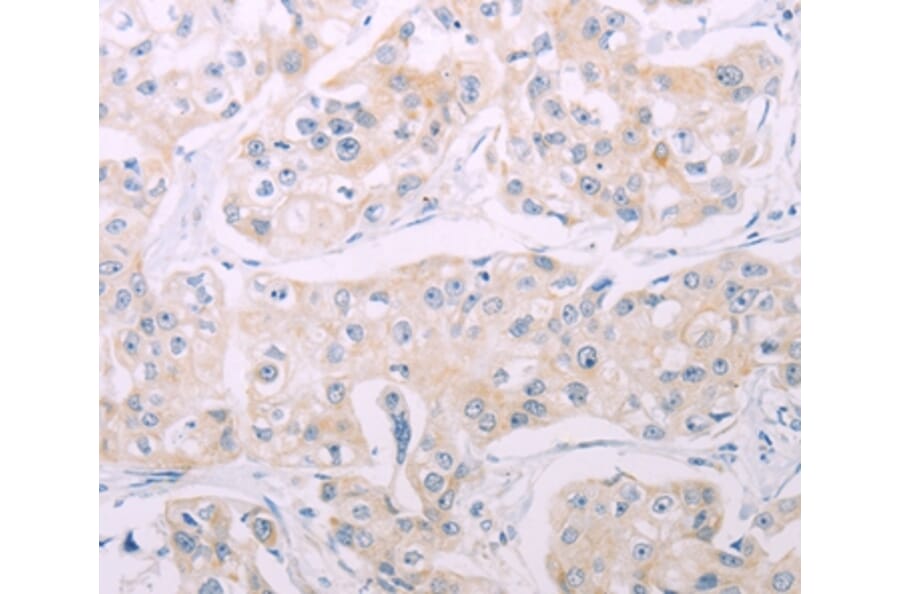 Immunohistochemistry - ADCY7 Antibody from Signalway Antibody (37316) - Antibodies.com