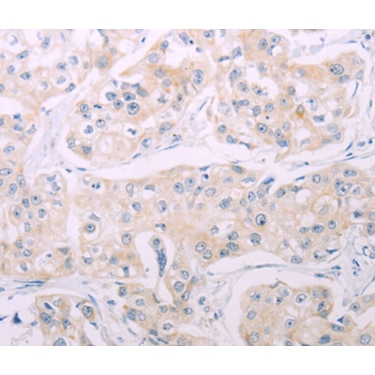 Immunohistochemistry - ADCY7 Antibody from Signalway Antibody (37316) - Antibodies.com