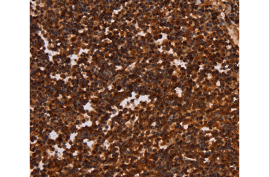 Immunohistochemistry - ALG11 Antibody from Signalway Antibody (37327) - Antibodies.com