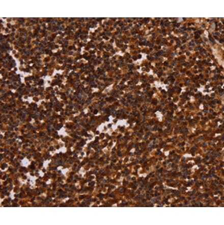 Immunohistochemistry - ALG11 Antibody from Signalway Antibody (37327) - Antibodies.com