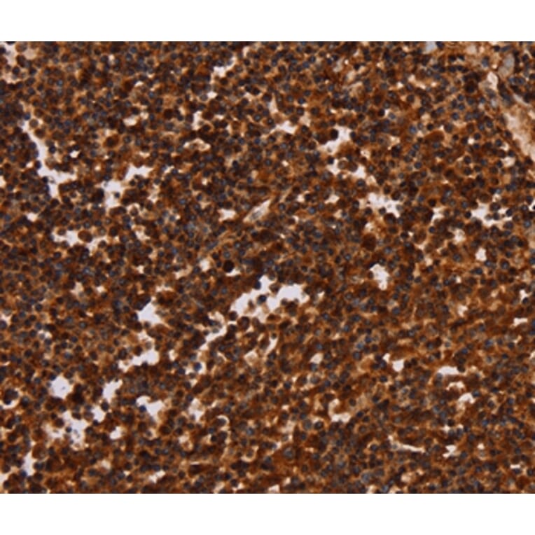 Immunohistochemistry - ALG11 Antibody from Signalway Antibody (37327) - Antibodies.com