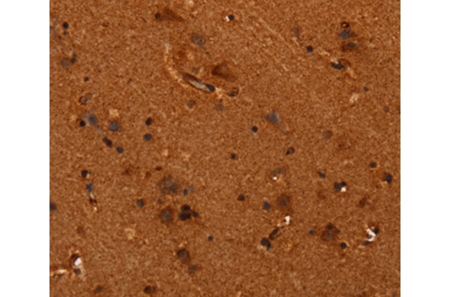 Immunohistochemistry - ALG11 Antibody from Signalway Antibody (37327) - Antibodies.com