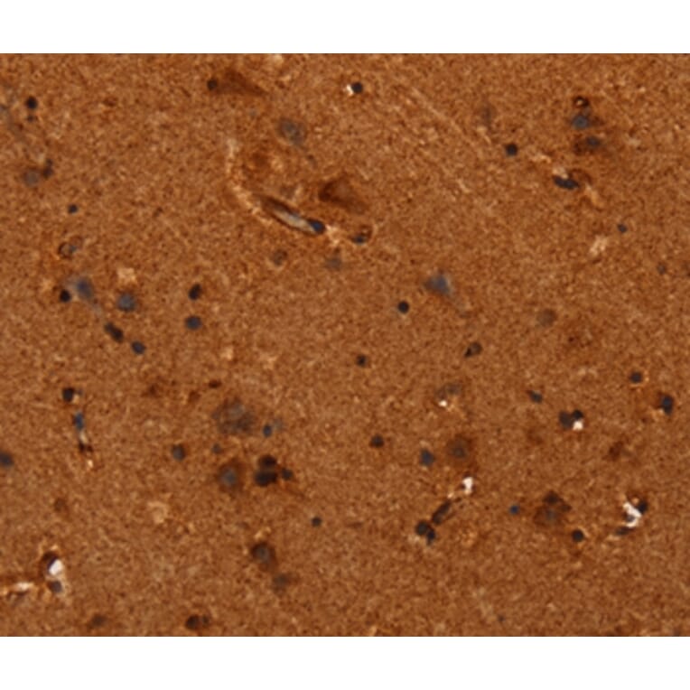 Immunohistochemistry - ALG11 Antibody from Signalway Antibody (37327) - Antibodies.com