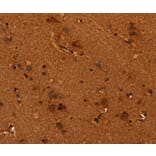 Immunohistochemistry - ALG11 Antibody from Signalway Antibody (37327) - Antibodies.com