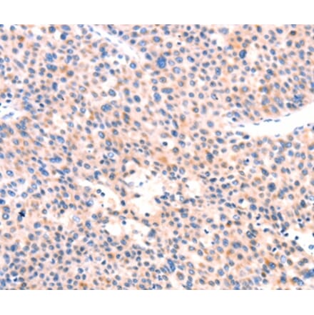 Immunohistochemistry - APBA2 Antibody from Signalway Antibody (37336) - Antibodies.com