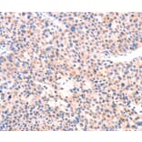 Immunohistochemistry - APBA2 Antibody from Signalway Antibody (37336) - Antibodies.com