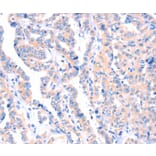 Immunohistochemistry - APBA2 Antibody from Signalway Antibody (37336) - Antibodies.com